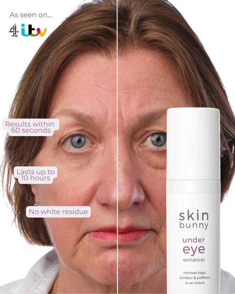 Smooth Under-Eye Bags in Minutes
