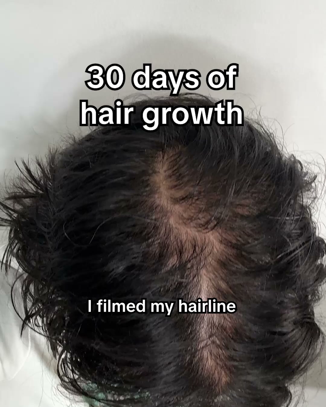 Regrowth Can Be Easy