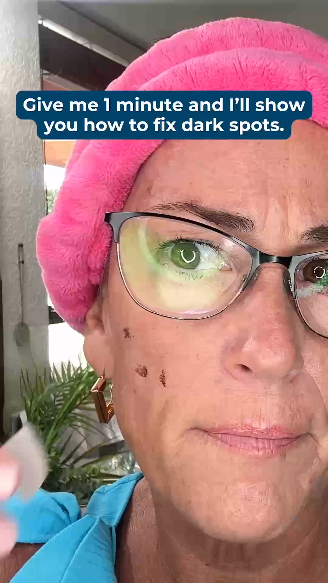 How to Stop Dark Spots Where They Start