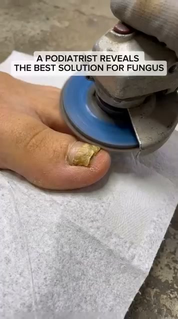 The Real Reason You’re Hiding Feet