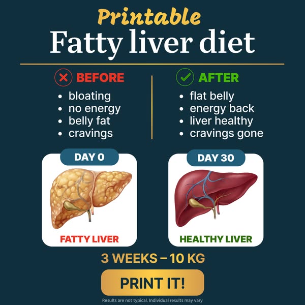 Start Liver Detox today!