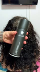 Seeing More Scalp Lately?