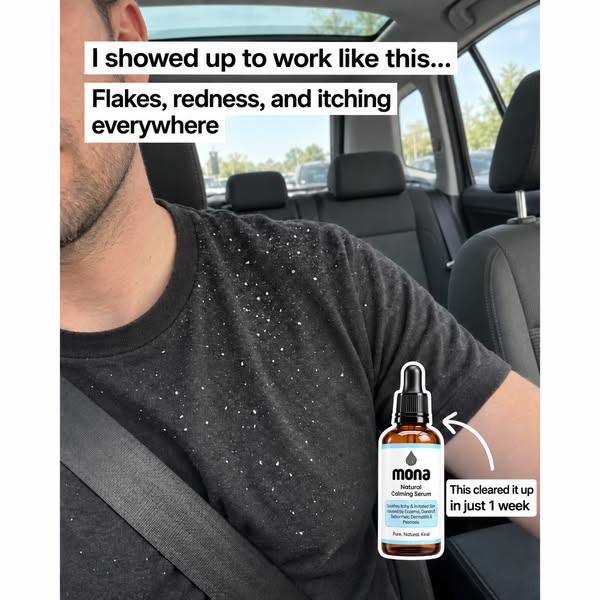 Anti-Dandruff Balancing Serum
