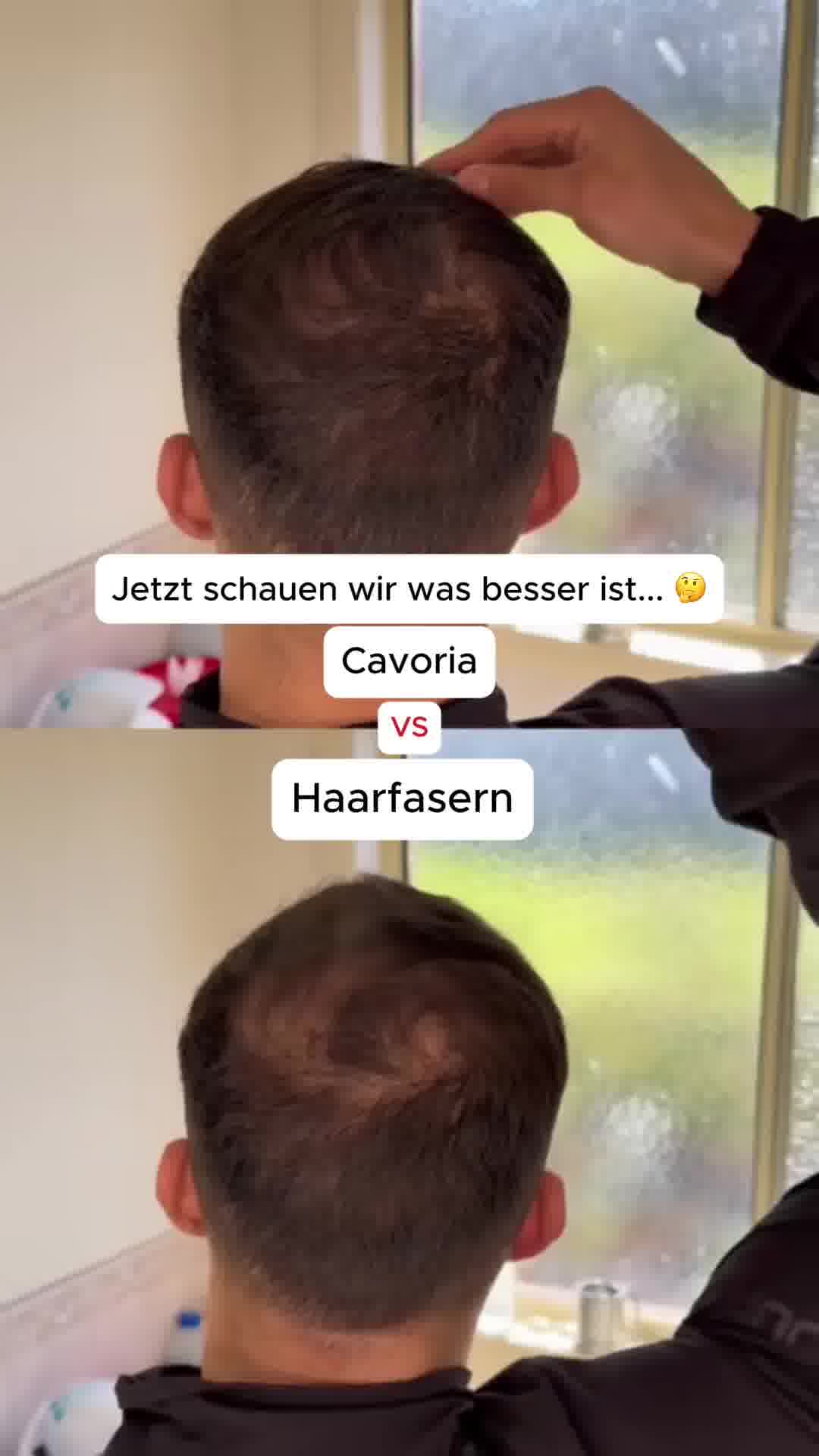 Hol dir noch heute volleres und dickeres Haar zurück!