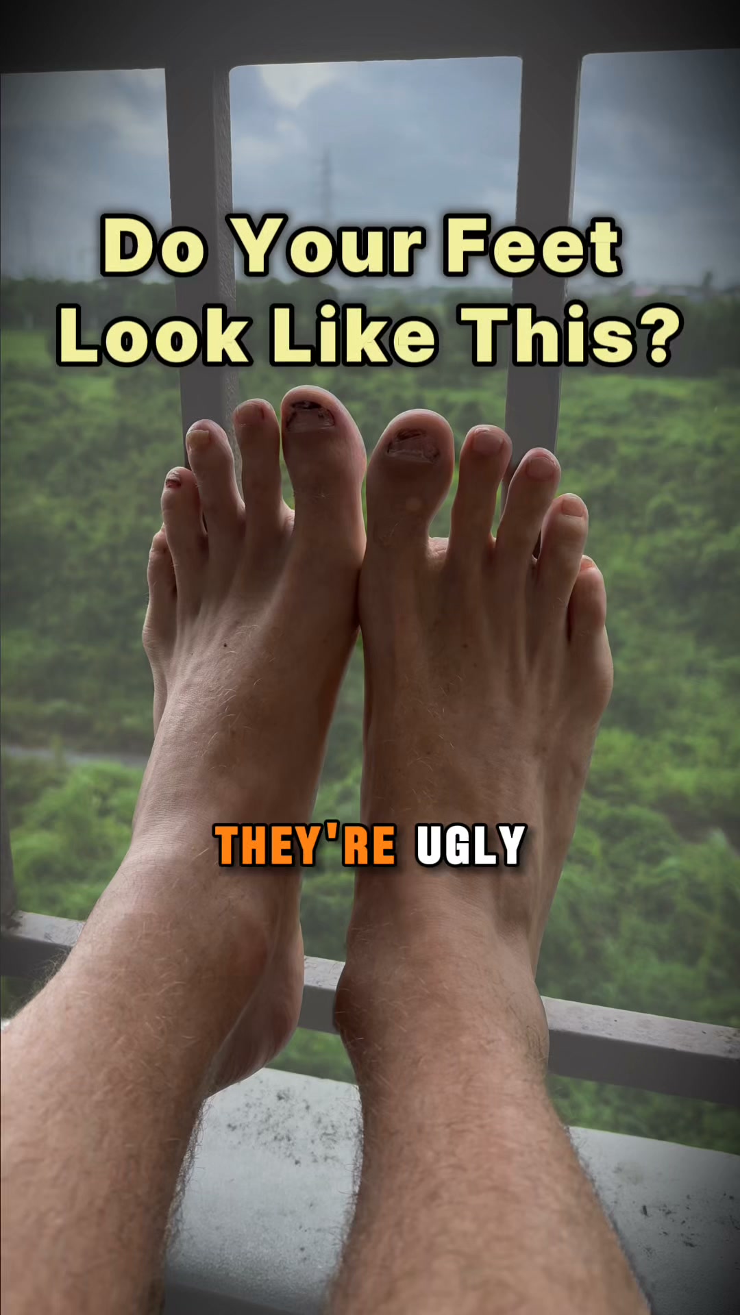 Shoes shape feet!