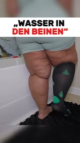 Schwellungen natürlich lindern