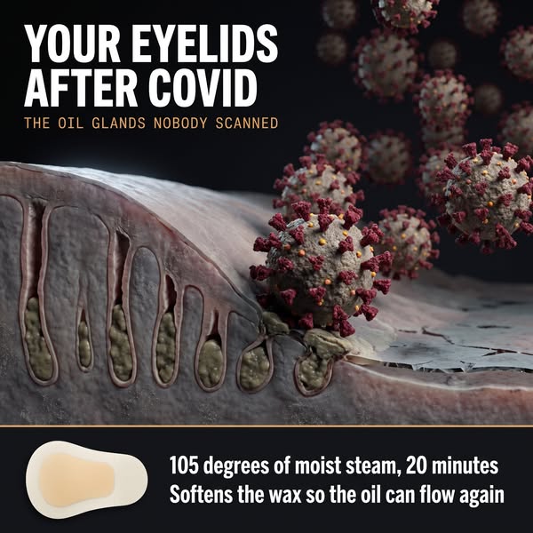 The Eye Change COVID Left Behind
