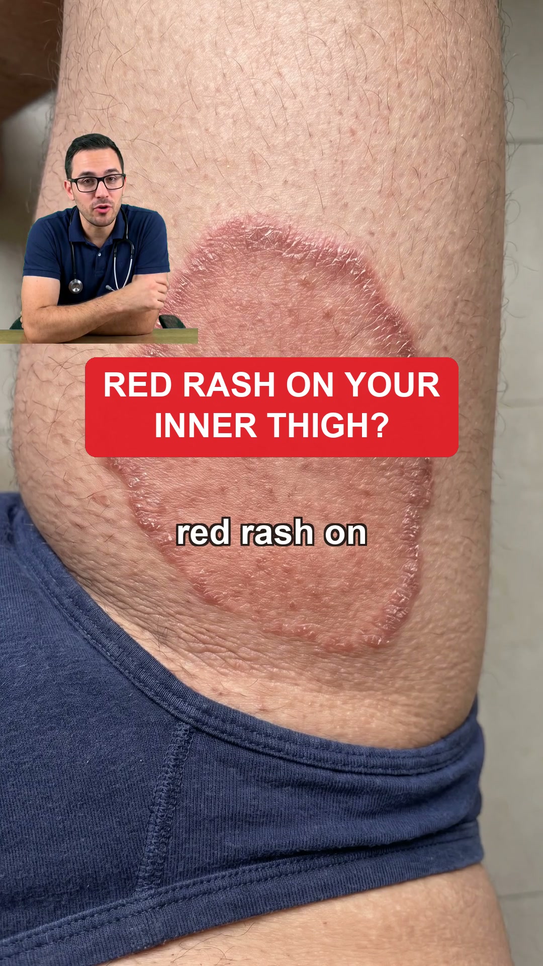 Itchy Balls? Stop The Itch In 60 Seconds