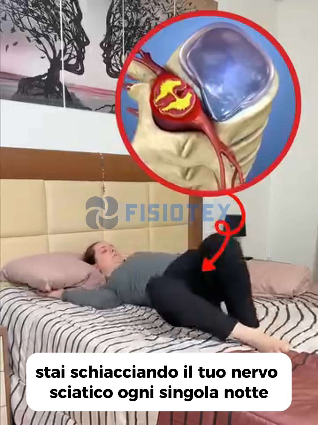 Elimina il dolore alla sciatica ora!