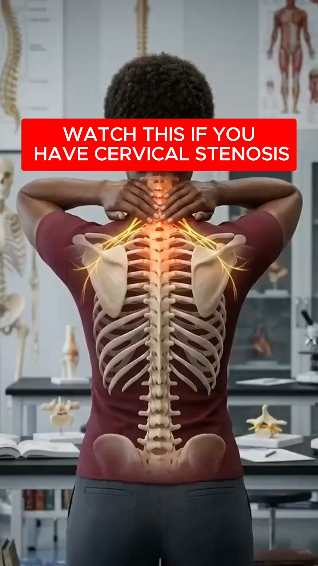 The Overlooked Muscle Behind Cervical Stenosis