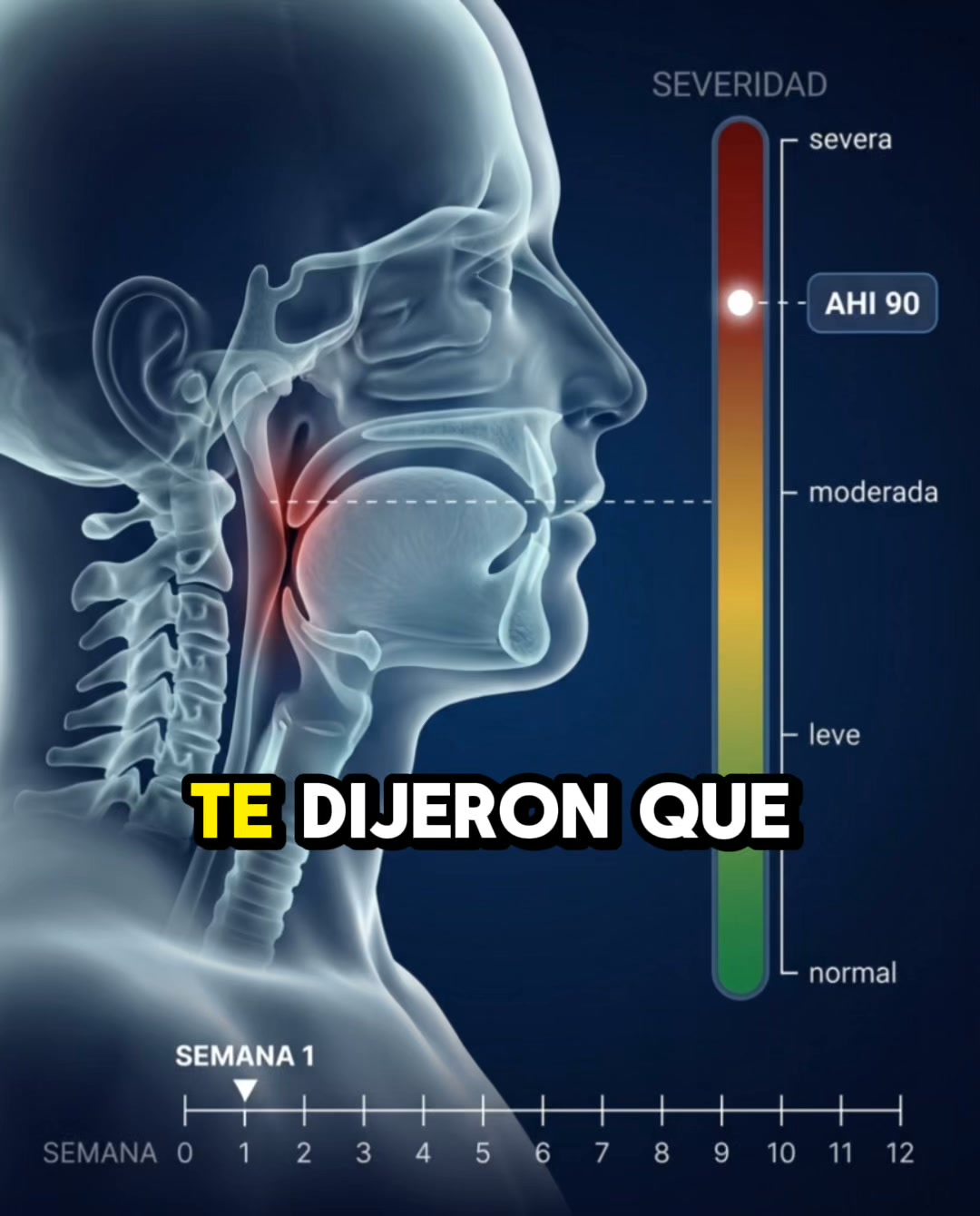 No lo tapes. Corrígelo.