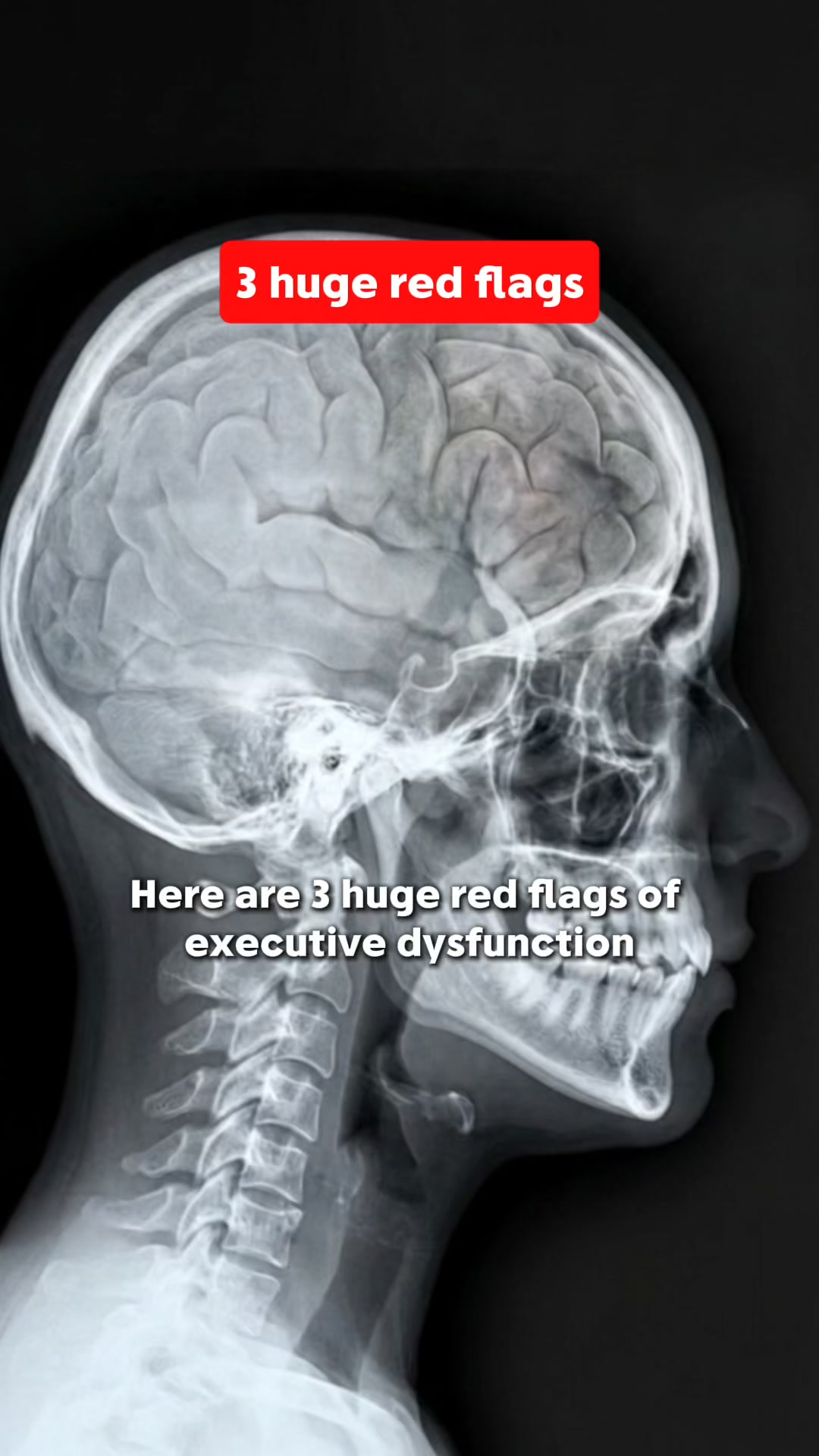 You're Not Lazy. Your Brain Just Needs This