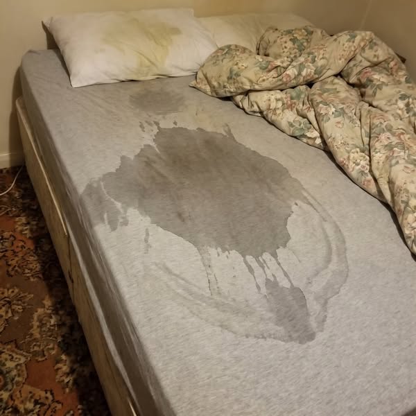 How do you stop snoring?