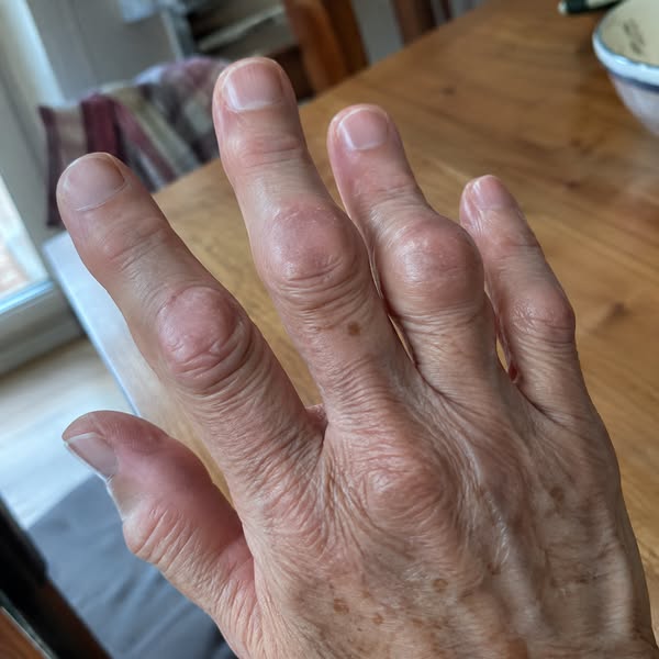 « Ma belle-fille m'a demandé d'ouvrir un bocal de cornichons. J'ai dit que je n'avais pas envie. »