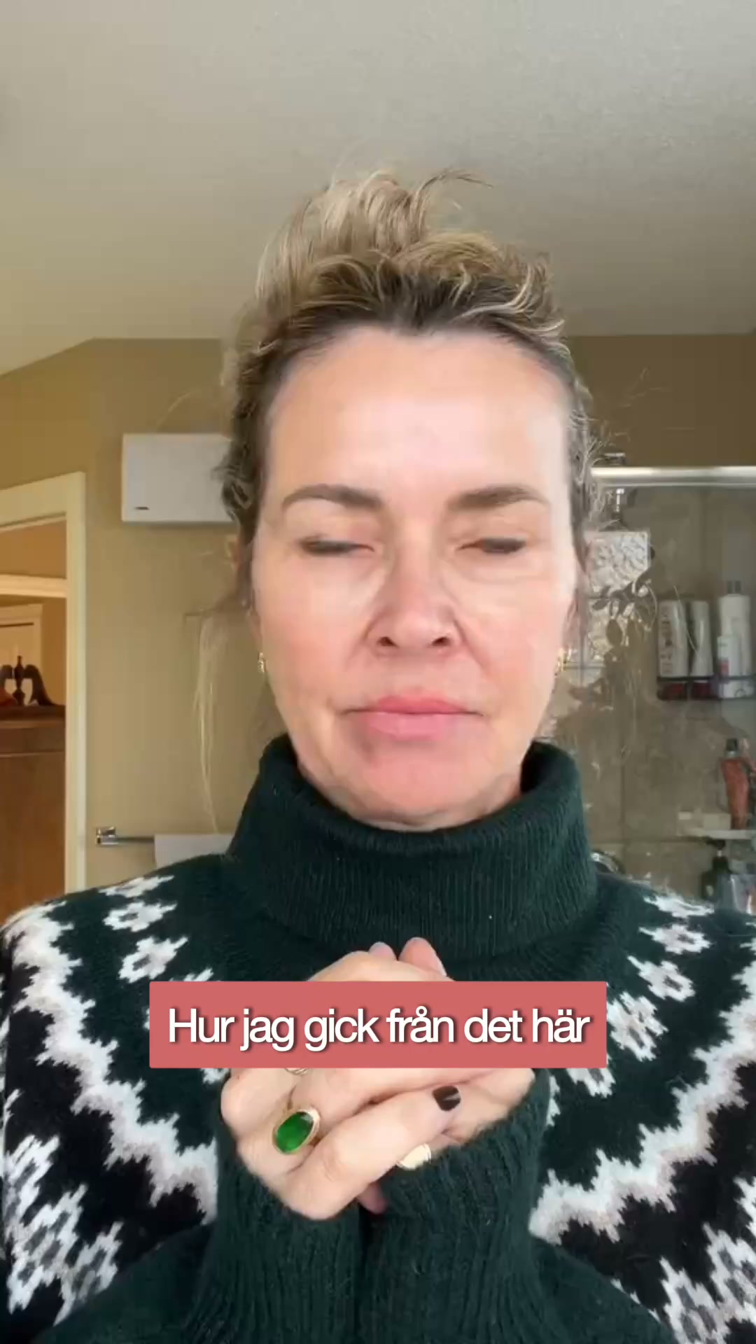 Slätare linjer utan botox