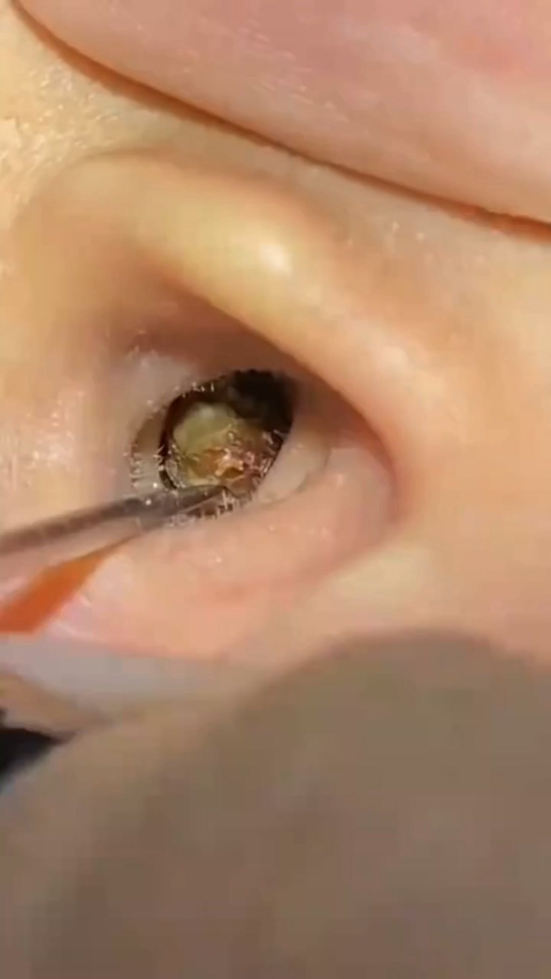 Et si vous changiez de méthode ?