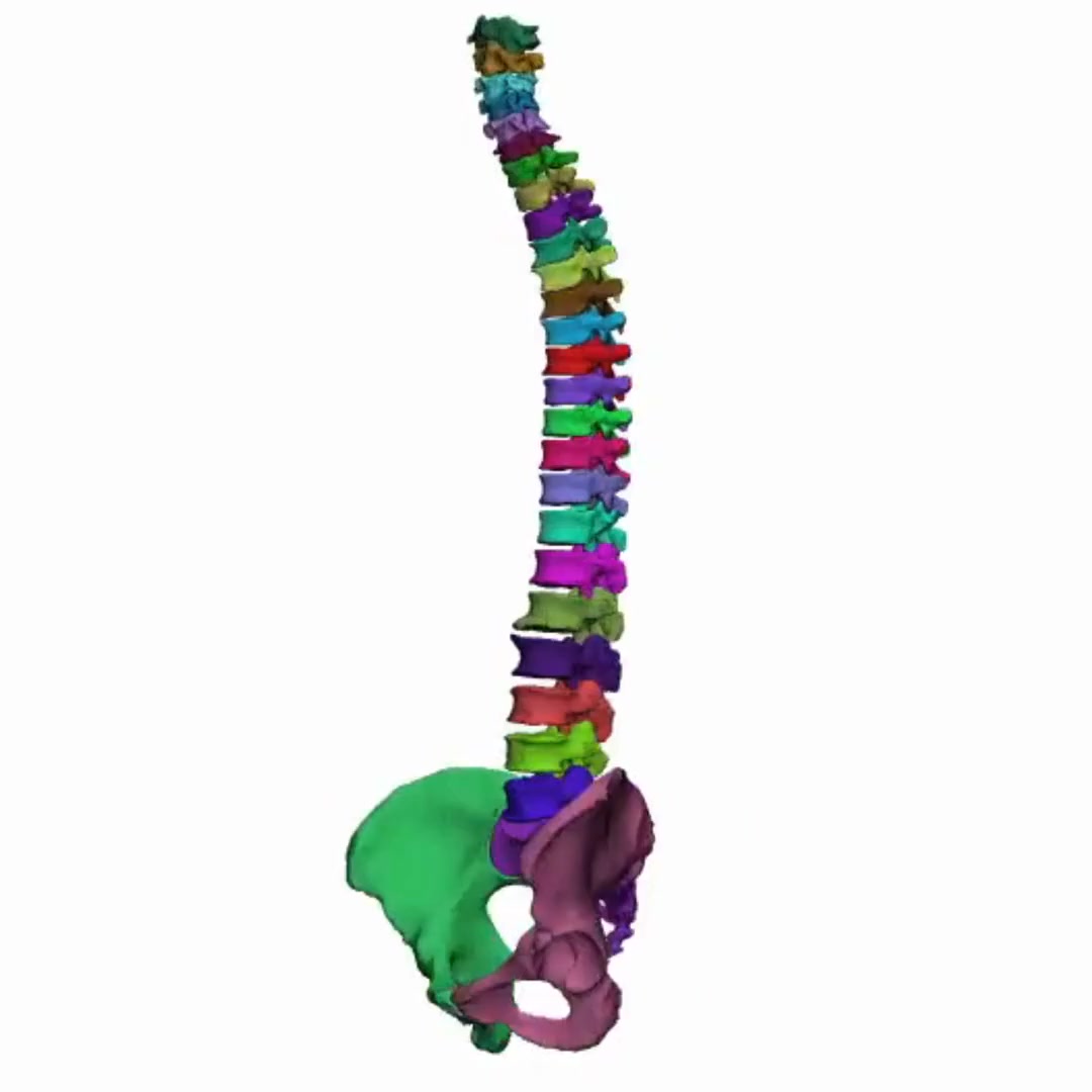 AI-Enabled Spine Segmentation | Mimics