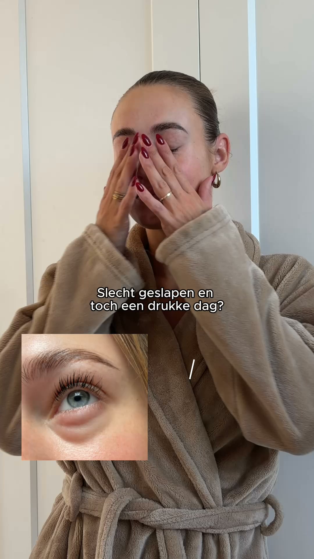 Weg met wallen in 15 minuten.
