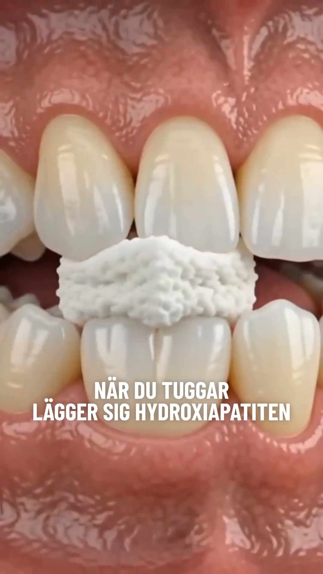 Ett tuggummi som förändrar dina tänder.
