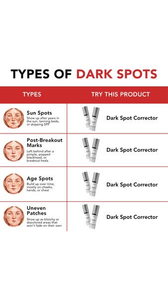 The Dark Spot Myth: The Real Reason Spots Keep Coming Back