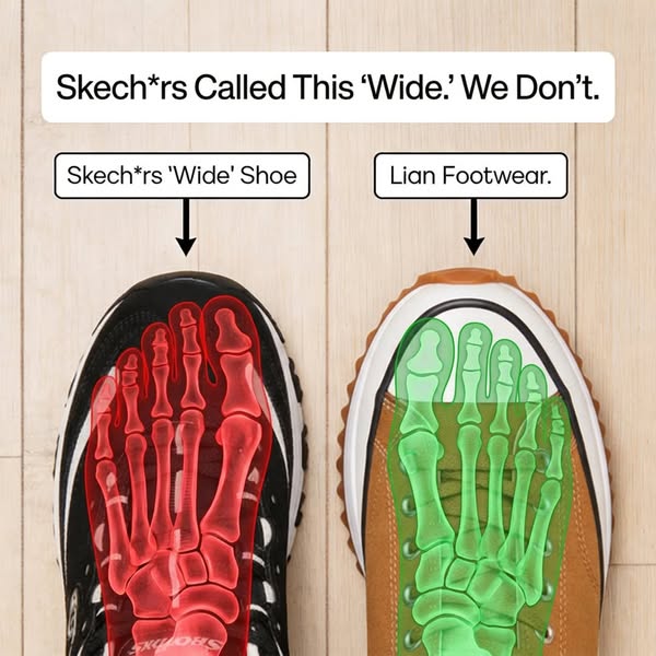 Walk Pain-Free Today!