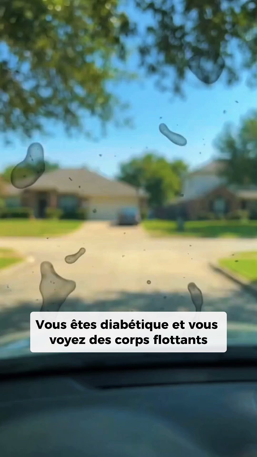 Reprenez le contrôle face à la dégénérescence maculaire