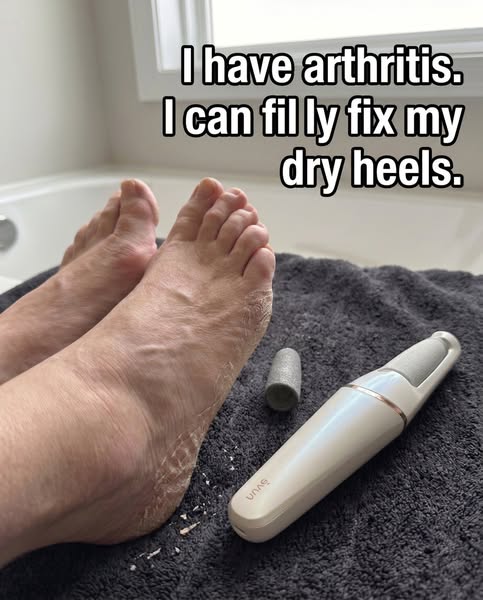 I have smooth heels!