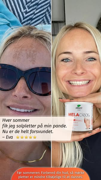 Mørke pletter? Behandl dem ved kilden