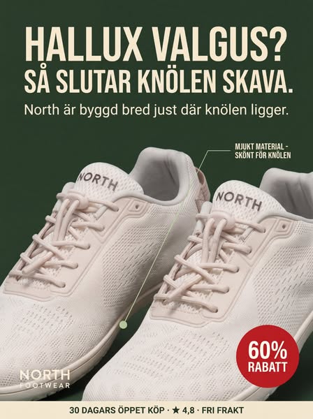 Hallux valgus? Läs det här innan du överväger operation