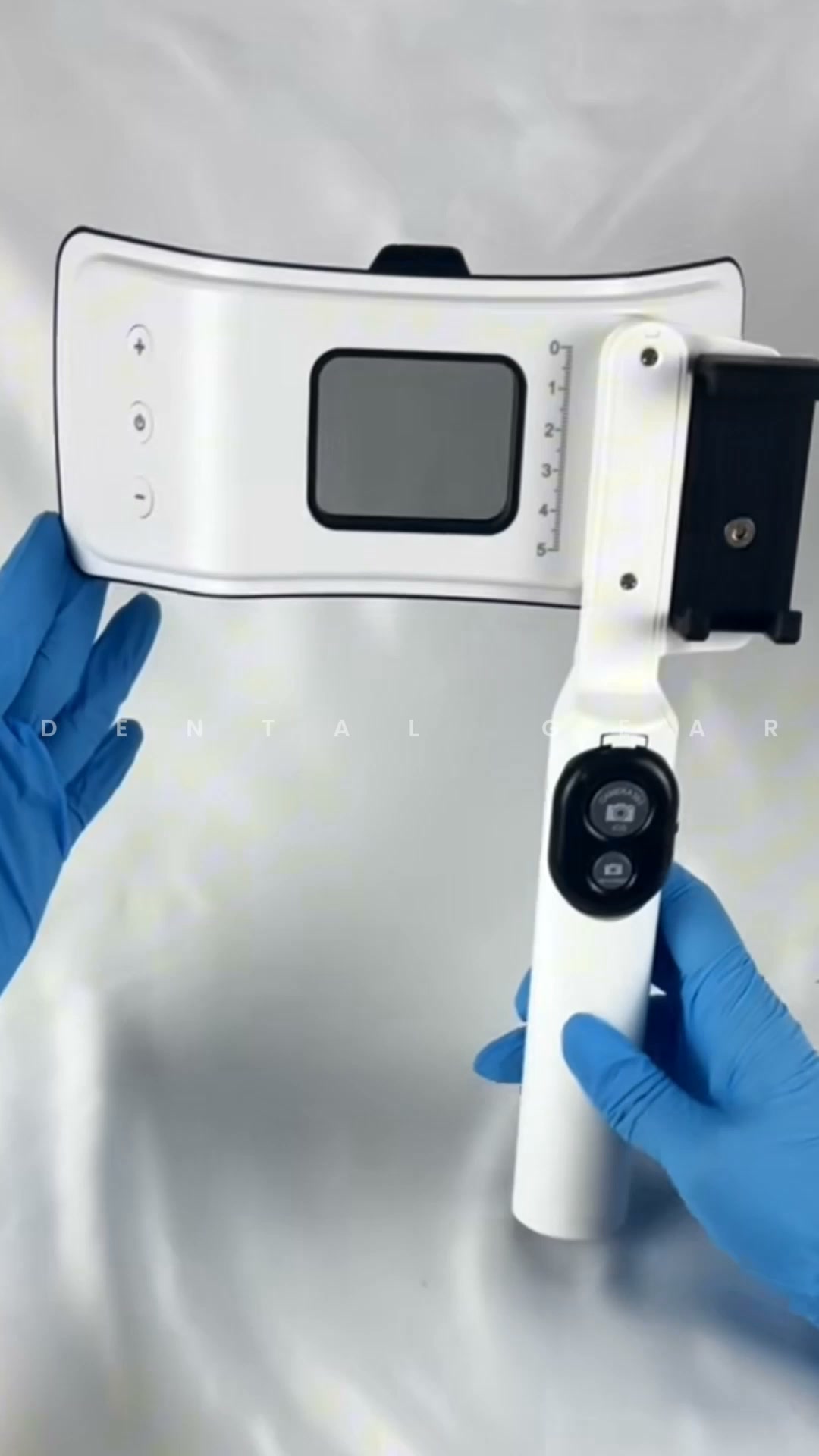 Better Dental Photos With Your Smartphone