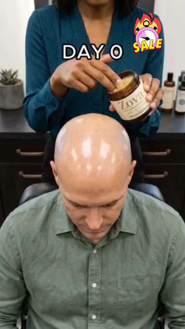The Ultimate Stem Cell Hair Growth Gel – Sale Now On!
