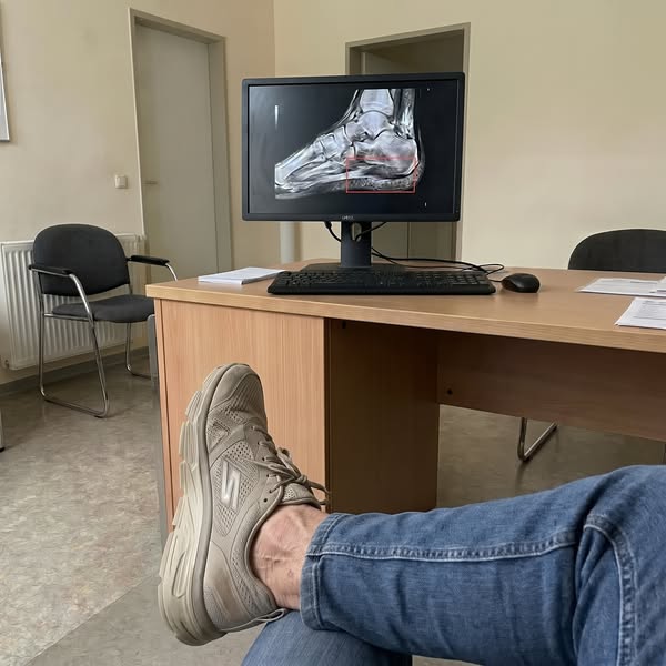 Plantarfasziitis bestimmte mein Leben, bis ich die Ursache fand...