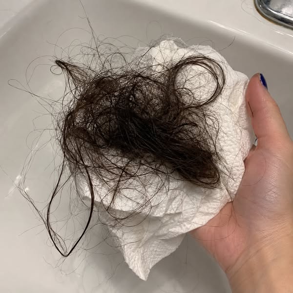 Read this if nothing you put on your scalp ever seems to work