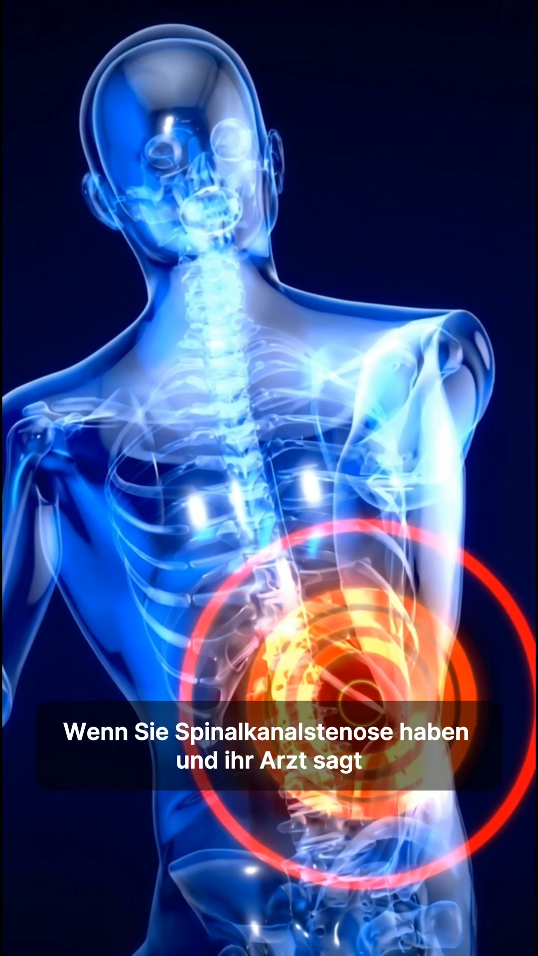 Rückenschmerzen? Deswegen ist eine OP ein Fehler