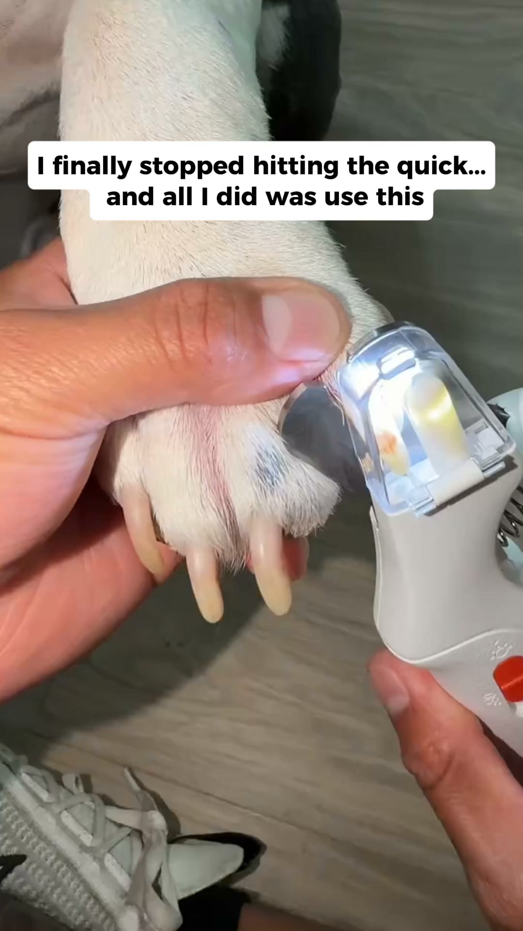 NailHero - See The Quick Before You Cut!