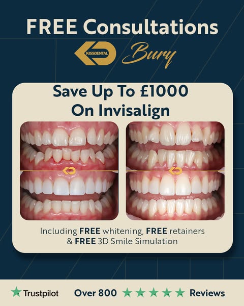 Save Over £1,000 On Invisalign