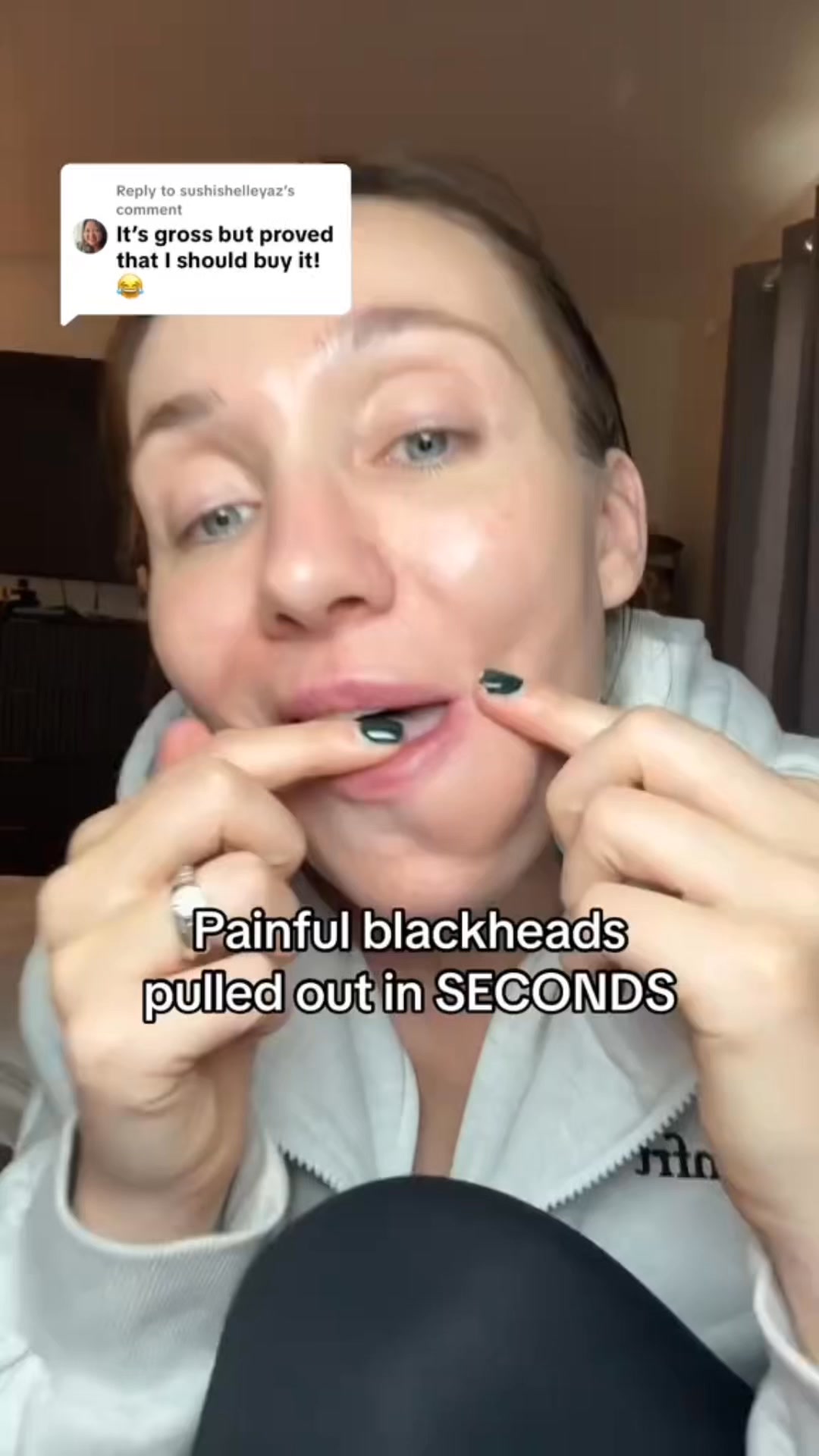 Say goodbye to blackheads