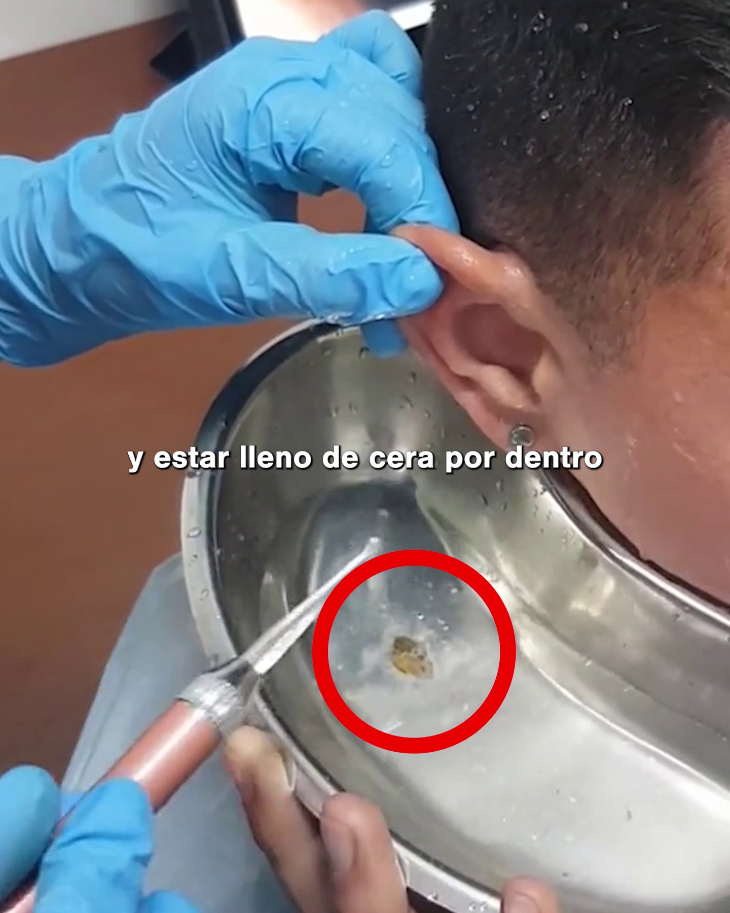 CONTRAREEMBOLSO