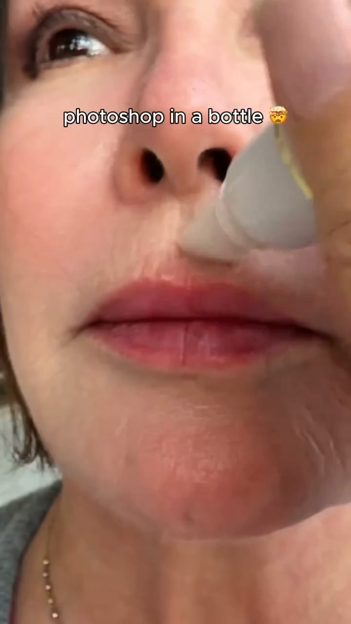 No Needles Required