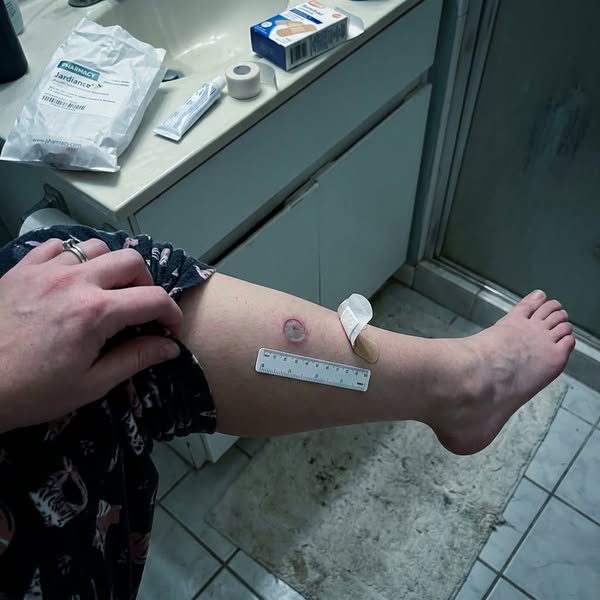 How I Dropped My A1C From 7.2 to 5.6 Without Meds