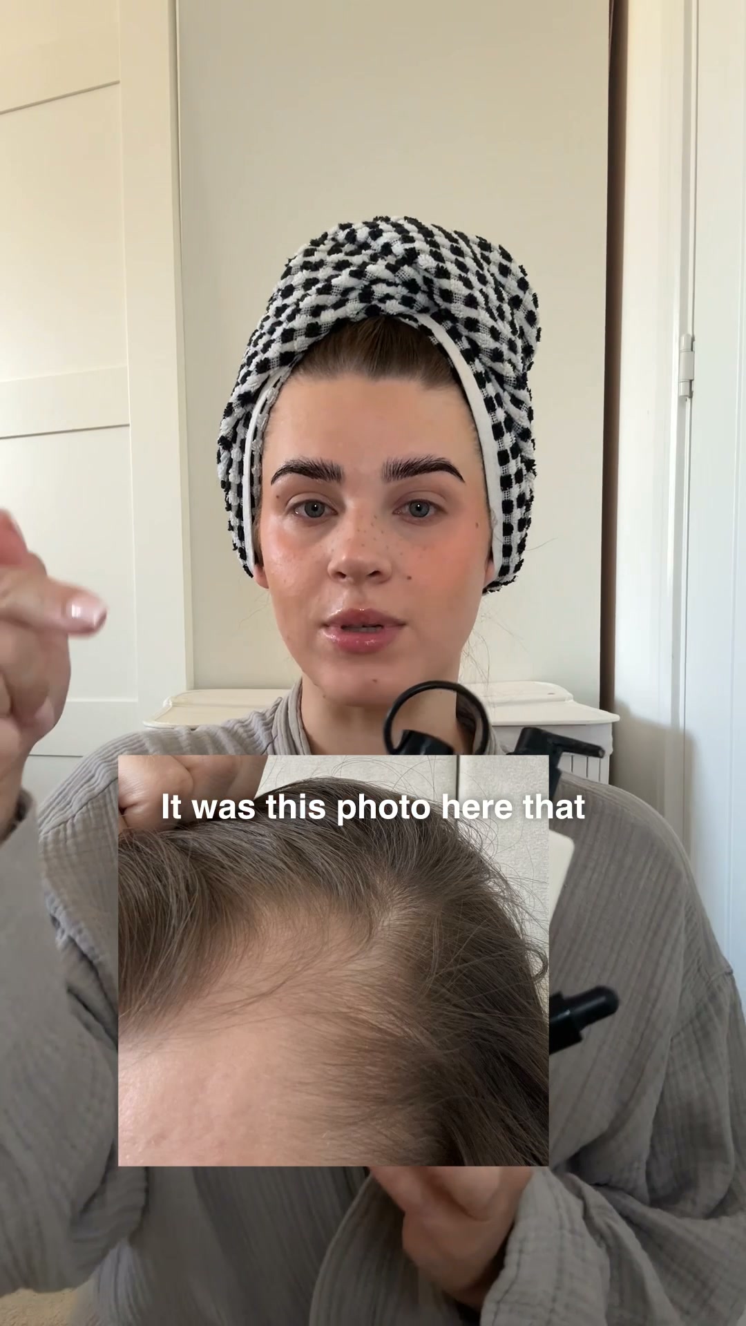 My postpartum hair journey with Chāmpo