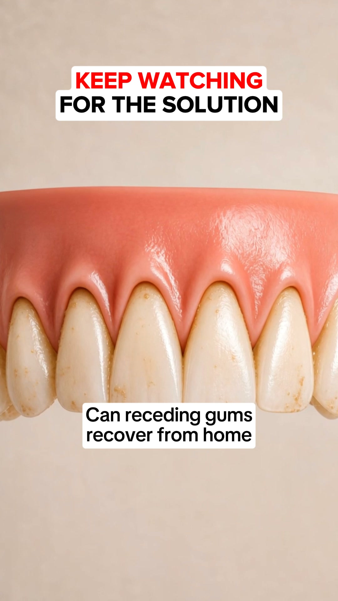 My Gums Kept Pulling Back