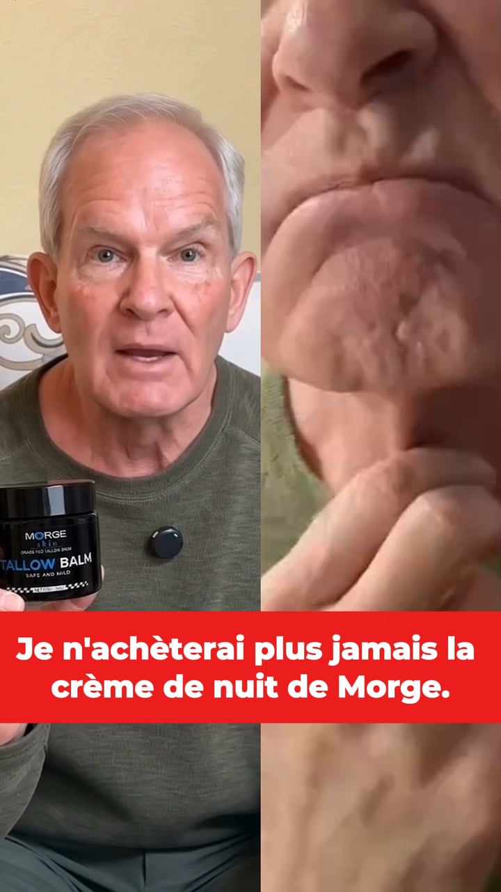 Une apparence plus forte et plus attirante