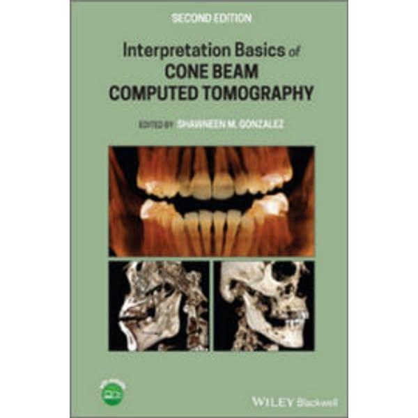 Interpretation Basics of Cone Beam Computed Tomography, 2nd Edition