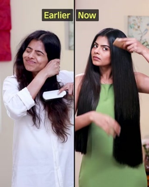 END Weak Hair, Thinning, & Hair Fall with Vedix!
