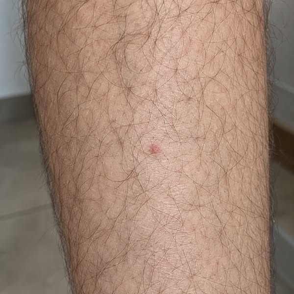 He Called the Red Marks “Getting Older.” Then He Found a Story He Couldn’t Forget.
