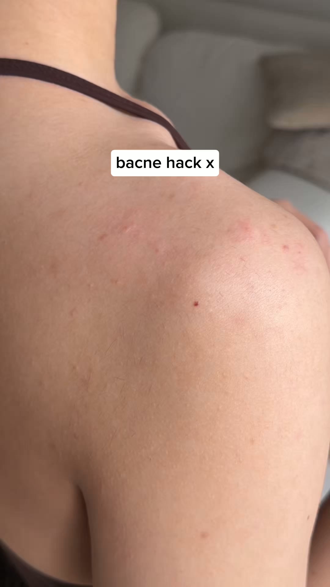 Unlock Clear Skin Today!