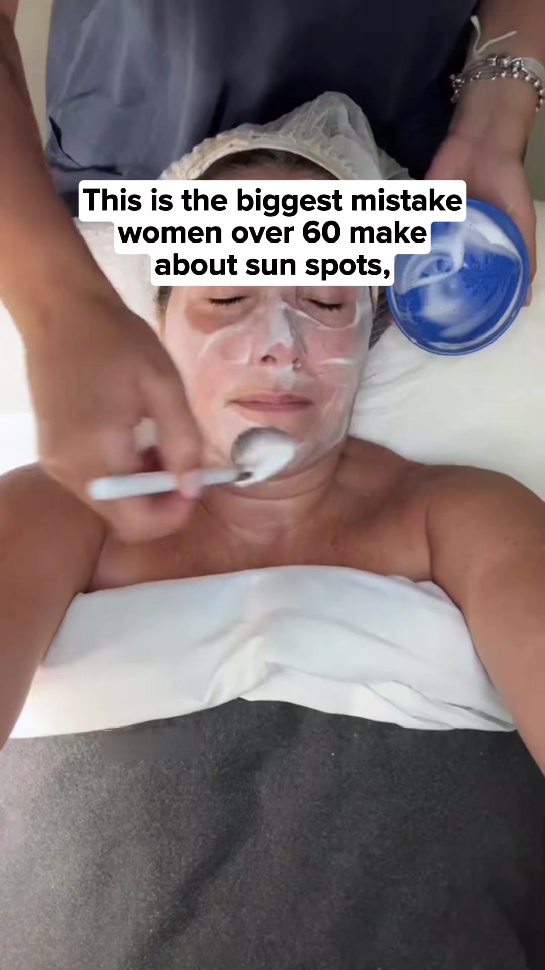 Designed for Age Spots.