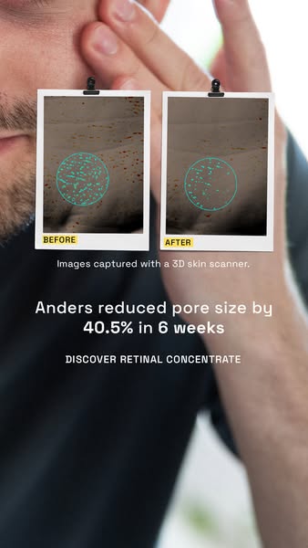 Reduce your pores with Retinal Concentrate