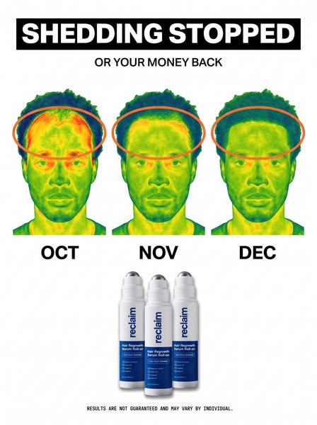 Shedding? Check What's Blocking Your Roots